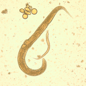 S_stercoralis_adult_larva_BAM2.jpg Figure C