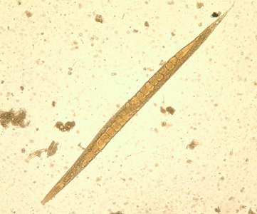 S_stercoralis_female_BAM1.jpg Figure D