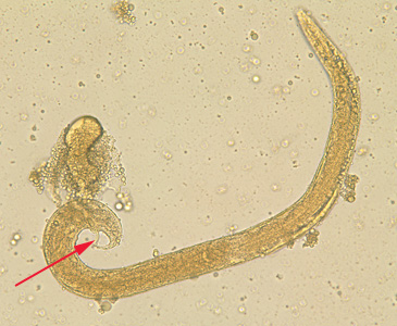 S_stercoralis_male_BAM1.jpg Figure A