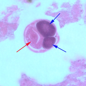 S_stercoralis_HE_1000x_BAM1.jpg Figure C