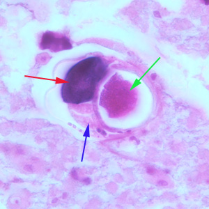 S_stercoralis_HE_1000x_BAM3.jpg Figure D