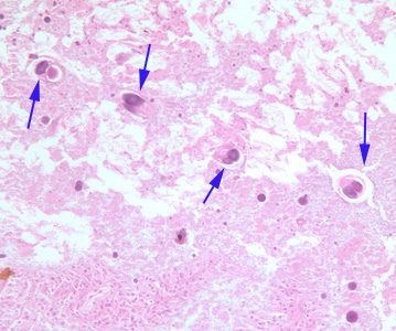 S_stercoralis_HE_200x_BAM1.jpg
