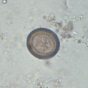 Taenia_egg.jpg