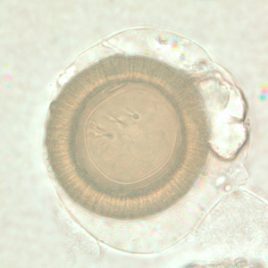 Taenia_egg1.jpg