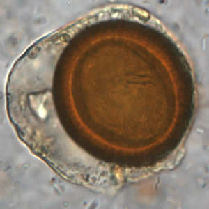 Taenia_egg_wtmt_OR.jpg