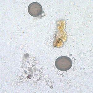 Taenia_eggs_wtmt_400x.jpg