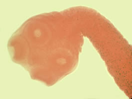 Taenia_saginata_scolex.jpg