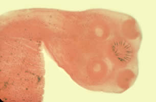 Taenia_solium_scolex1.jpg