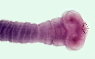 Taenia_solium_scolex2.jpg