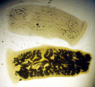 T_solium_proglottids_HB1.jpg