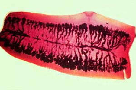 Taenia_saginata_carmine.jpg