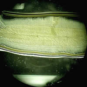 Taenia_saginata_proglottid_OR.jpg