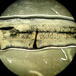 Taenia_saginata_proglottid_OR_ink.jpg