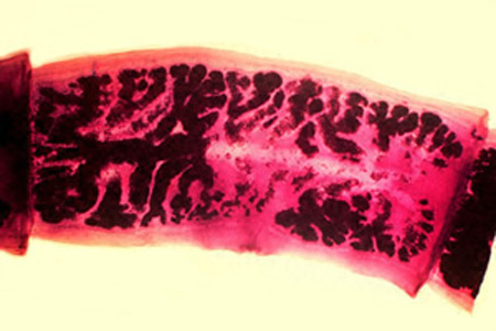 Taenia_solium_carmine.jpg