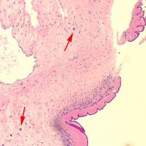 Taenia_cuticle.jpg