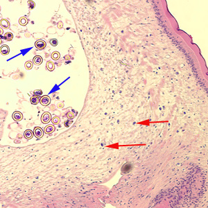 Taenia_cuticle2.jpg