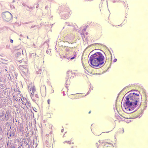 Taenia_eggs_HE2.jpg