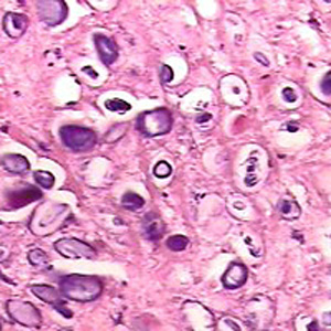 calcareous_corpuscles2.jpg
