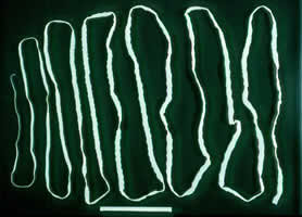 Taenia_saginata_adult1.jpg