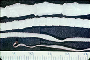 Taenia_saginata_adult2.jpg