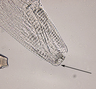 Thelazia_anterior_HB1.jpg
