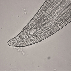 Thelazia_posterior_HB1.jpg