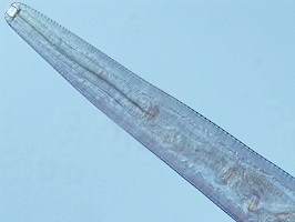 Figure C Thelaziasis
