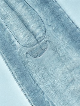 FigureE thelaziasis image