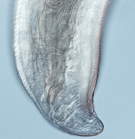 FigureG thelaziasis image