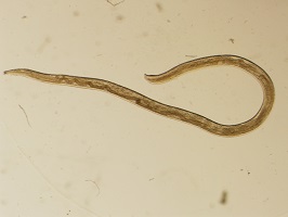 FigureH thelaziasis image