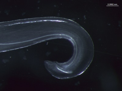Tcallipaeda_E Figure E: Posterior of adult male Thelazia callipaeda showing spicules (Nomarsky phase contrast).