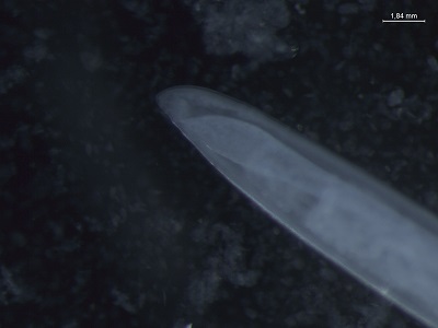 Tcallipaeda_F Figure F: Posterior of adult female Thelazia callipaeda showing anal opening (Nomarsky phase contrast)