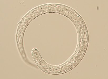LarvaeA Figure A: L1 larva of Thelazia sp., likely T. callipaeda based on the patient’s travel history. L1 larvae measure up to 400 µm long and 13.5 µm wide. While not visible on this specimen, normally larvae are passed encased in a shell membrane.