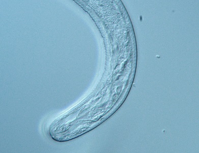 LarvaeB Figure B: Anterior end of the larva. Note the lack of buccal cavity, and the developing cuticular striations.