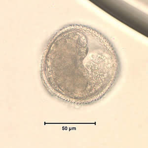 Toxocara_egg_wtmt.jpg