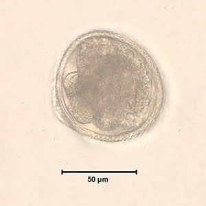 Toxocara_egg_wtmt2.jpg