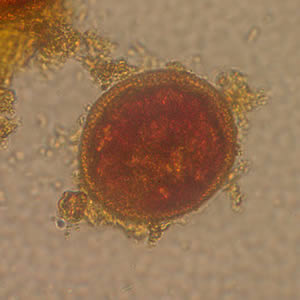 Toxocara_egg_wtmt4_AK.jpg Figure C
