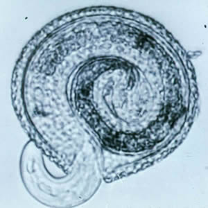 Toxocara_egglarva.jpg
