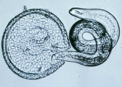 Toxocara_egglarva2.jpg