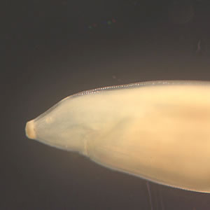 Toxocara_worm2_posterior.jpg
