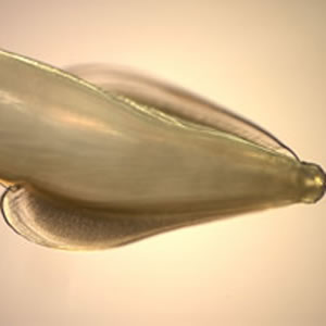 Toxocara_worm3_anterior.jpg Figure D