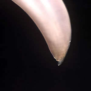 Toxocara_worm_posterior.jpg Figure E