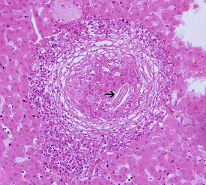 Toxo_canis_liver