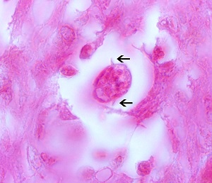 Toxo_cati_alae Figure E