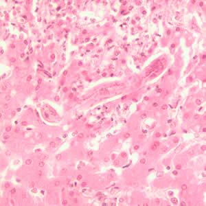 Toxocara_larva2_he.jpg