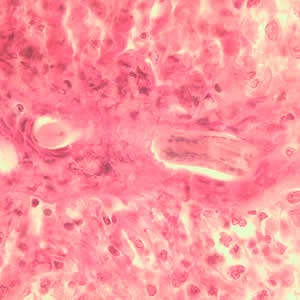 Toxocara_larva3_he.jpg