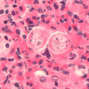 Toxocara_larvae_he.jpg