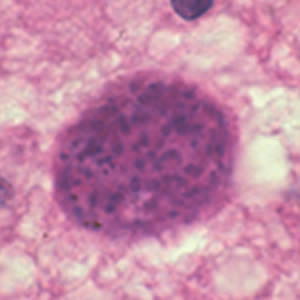 T_gondii_cyst_brain2.jpg