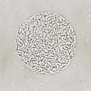 T_gondii_cyst_unstained.jpg