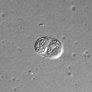 T_gondii_DIC_sporu_100X1.jpg